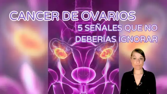 5 señales para detectar el cáncer de ovario, prevención del cáncer de ovario, síntomas del cáncer de ovario