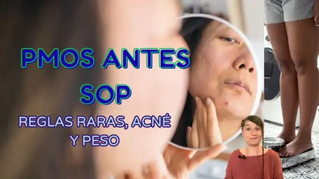PMOS antes conocido como SOP, reglas raras que produce PMOS antes SOP, acné por PMOS antes SOP